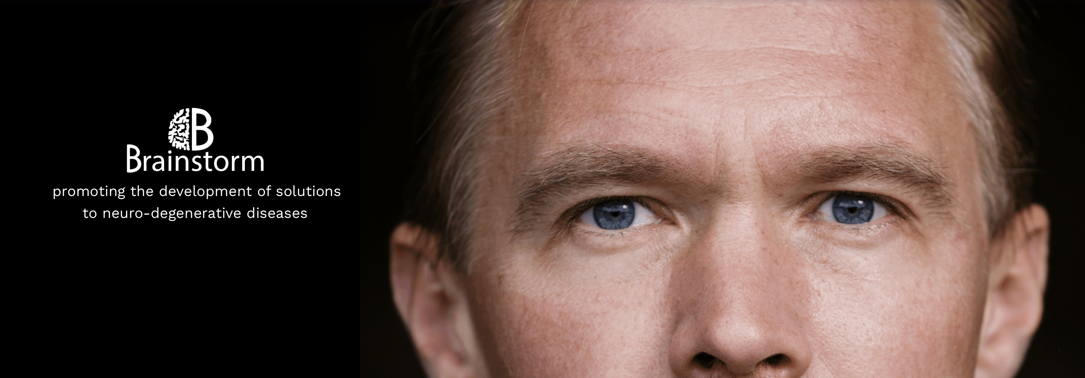 Market Failure? kENUP and YUVEDO High-Level Online Event Kick-starts Call for Projects Tackling the Growing Threat of Parkinson’s and Other Neurodegenerative Diseases.