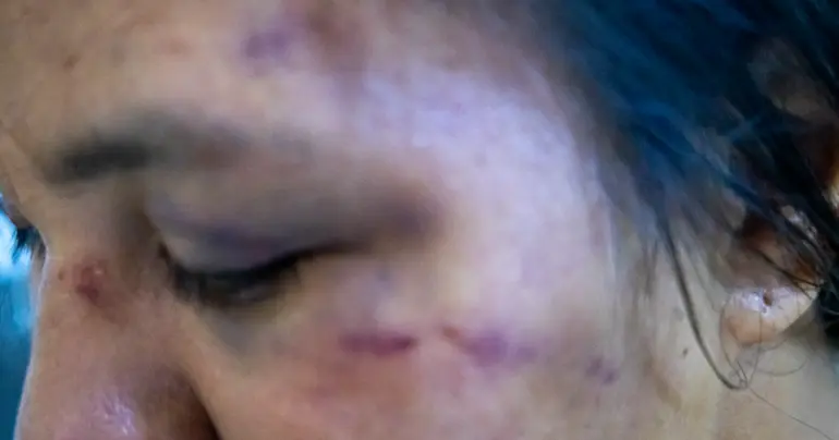 Silence on domestic violence results in more violence