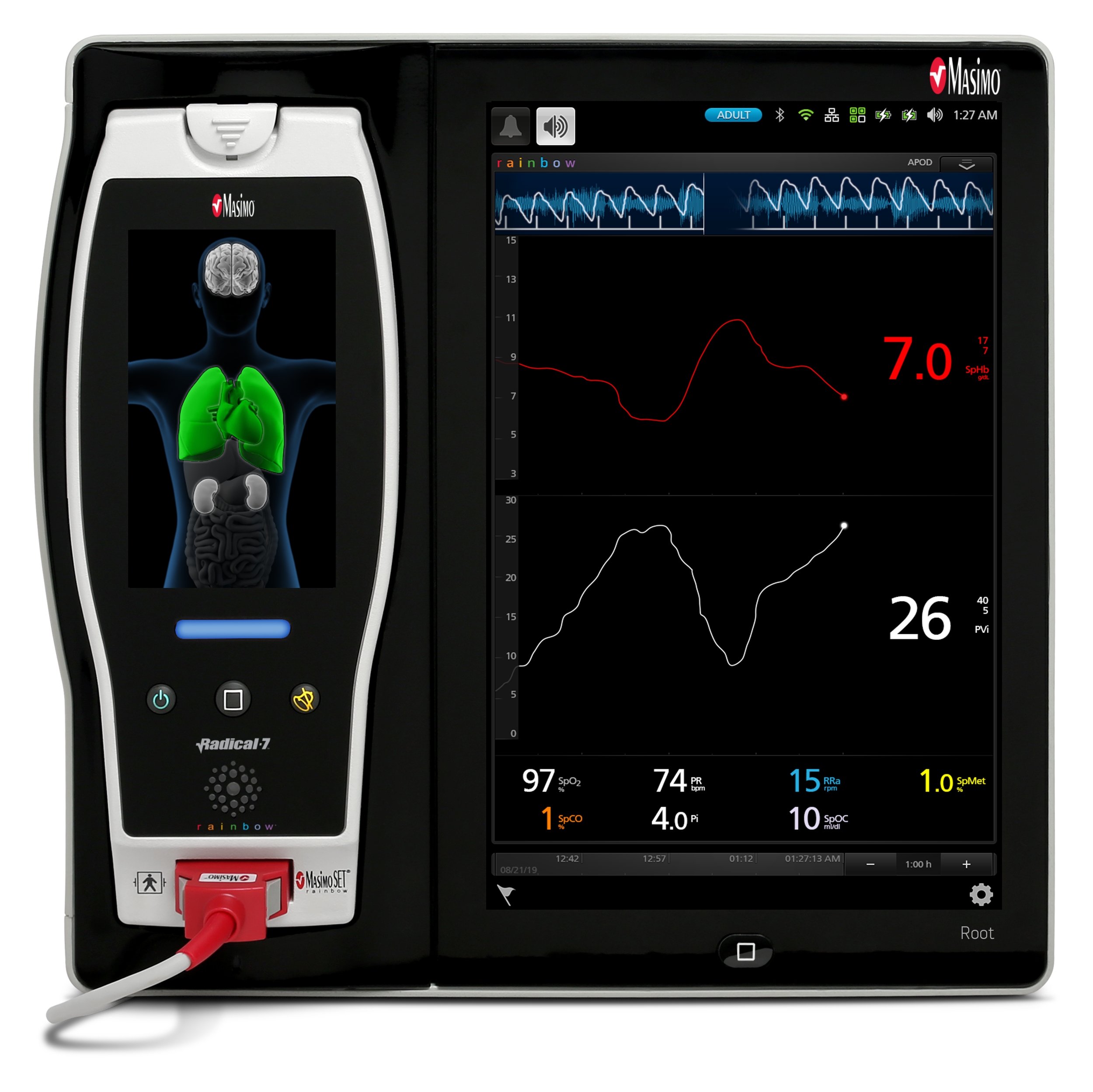Study Demonstrates Reduction in Mortality Using Masimo Noninvasive, Continuous Hemoglobin (SpHb®) and Pleth Variability Index (PVi®) Monitoring