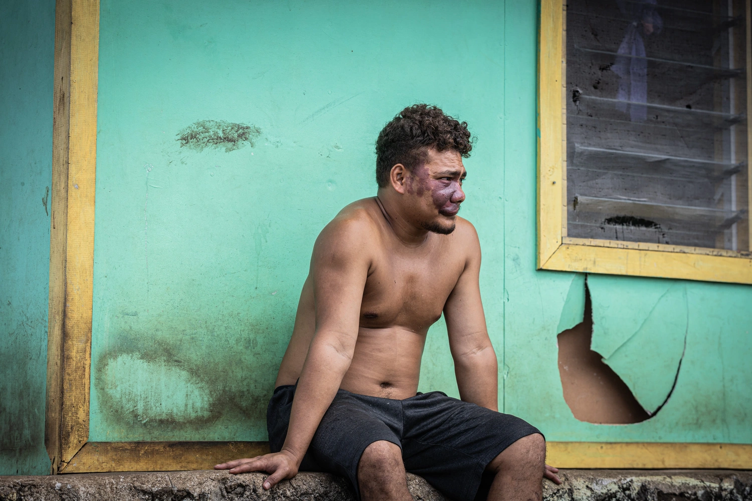 Why did police turn a blind eye to the alleged beating?