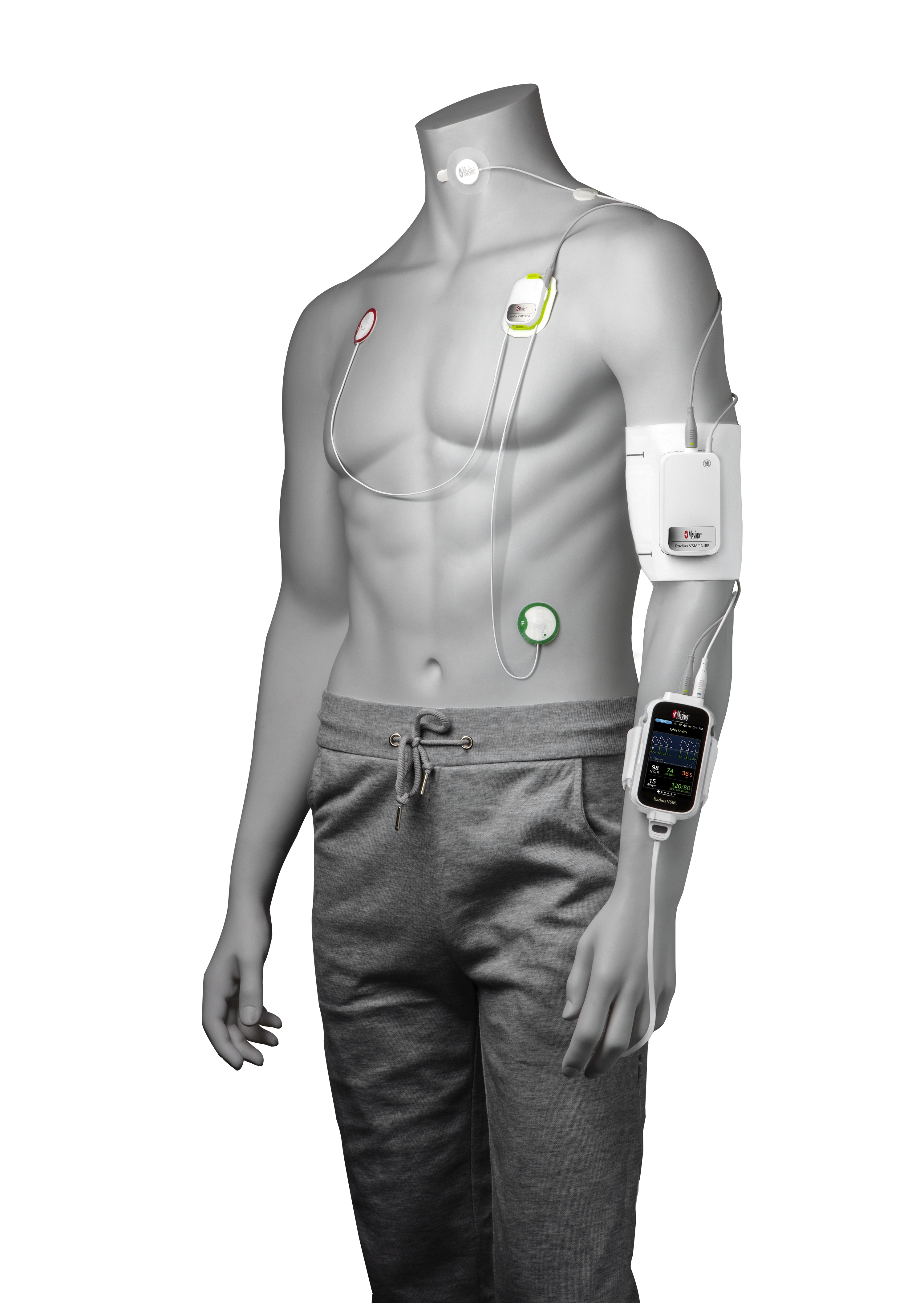 Masimo Announces Limited Market Release of Radius VSM™