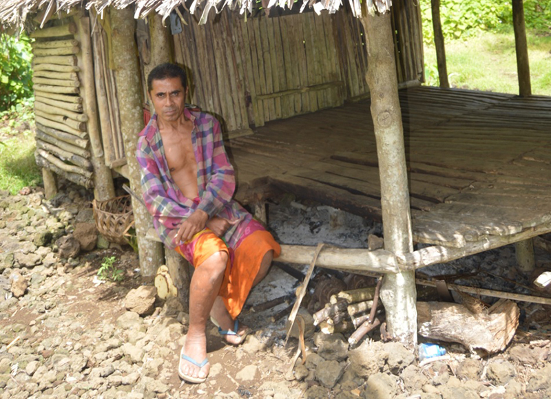 African singer makes persecution of fellow albinos visible