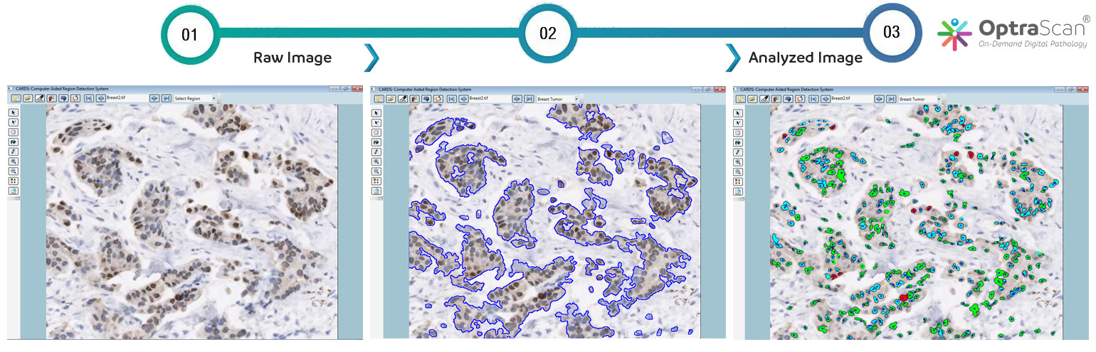 US Patent for Detecting Tissue Area of Interest, Granted to OptraSCAN®