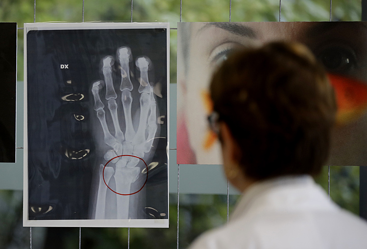 Milan hospital displays X-rays of women attacked by men
