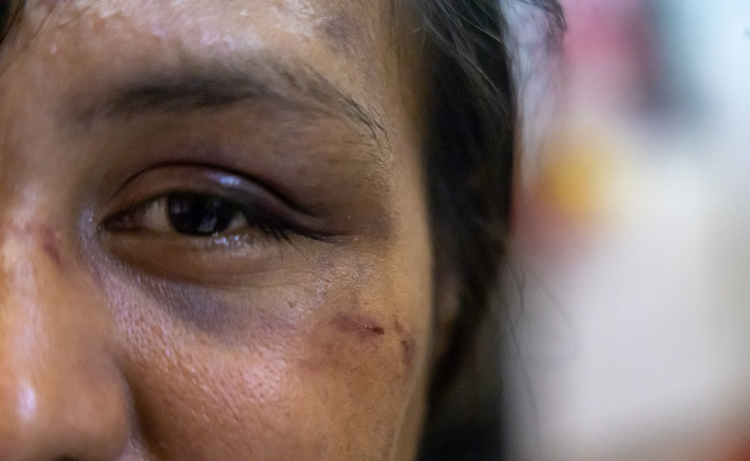 Not dropping violence cases is a good start